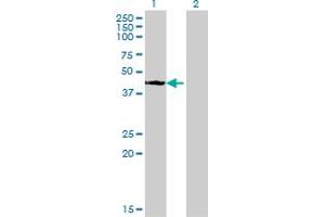 Western Blot analysis of STYK1 expression in transfected 293T cell line by STYK1 monoclonal antibody (M02), clone 3D2. (STYK1 抗体  (AA 50-159))