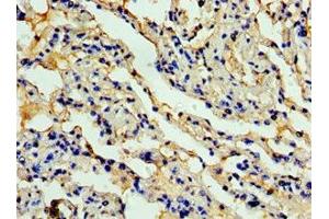 Immunohistochemistry of paraffin-embedded human lung tissue using  at dilution of 1:100 (CCL11 抗体  (AA 1-97))