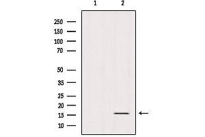 Western blot analysis of extracts from Mouse Spleen, using Histone H3K79me2 Antibody.