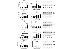 mRNA expression (all n = 6) of HRas, MAPK14 (p38), CCL2, DOK1 and PTK2B related to GAPDH mRNA expression, protein expression of HRas (n = 6), p38 (n = 6), CCL2 (n = 4), DOK1 (n = 7-8) and PTK2B (n = 3) related to GAPDH expression in A549 () and A549rCDDP2000 () before (ctrl) and after treatment with 11 μM cisplatin (11) or 34 μM cisplatin (34) presented as mean ± SEM, as well as representative Western blots. (DOK1 抗体)
