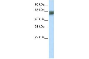 WB Suggested Anti-ARID3B Antibody Titration:  1. (ARID3B 抗体  (N-Term))