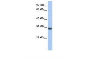 Image no. 1 for anti-Myeloid Leukemia Factor 1 (MLF1) (AA 38-87) antibody (ABIN6738901) (MLF1 抗体  (AA 38-87))