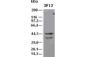 DFF45 antibody (3F12) at 1:500 dilution + Hela cell lysate (DFFA 抗体)
