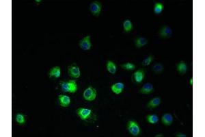 Immunofluorescent analysis of A2780 cells using ABIN7165108 at dilution of 1:100 and Alexa Fluor 488-congugated AffiniPure Goat Anti-Rabbit IgG(H+L) (ARV1 抗体  (AA 1-143))