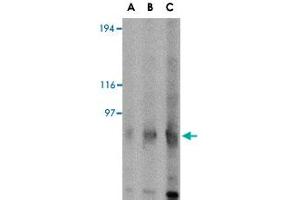 Western blot analysis of GRIK4 in rat brain tissue lysate with GRIK4 polyclonal antibody  at (A) 0. (GRIK4 抗体  (C-Term))