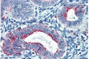 Human Uterus: Formalin-Fixed, Paraffin-Embedded (FFPE) (TYMS 抗体  (AA 111-211))