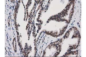 Image no. 1 for anti-Protein Kinase C, epsilon (PRKCE) antibody (ABIN1500230) (PKC epsilon 抗体)