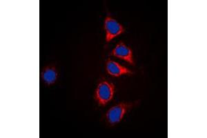 Immunofluorescent analysis of DUSP6 staining in HepG2 cells. (DUSP6 抗体  (Center))