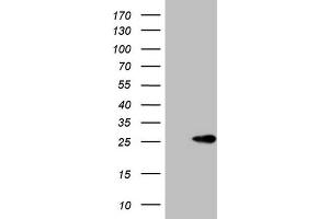 Western Blotting (WB) image for anti-ATP-Binding Cassette, Sub-Family C (CFTR/MRP), Member 5 (ABCC5) antibody (ABIN2715617) (ABCC5 抗体)