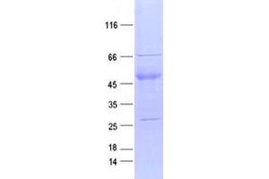 Validation with Western Blot