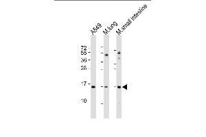 Western Blotting (WB) image for anti-Phospholipase A2, Group IIA (Platelets, Synovial Fluid) (PLA2G2A) (AA 32-62) antibody (ABIN6244010)