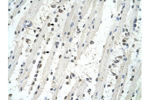 TRIM32 antibody was used for immunohistochemistry at a concentration of 4-8 ug/ml to stain Skeletal muscle cells (arrows) in Human Muscle. (TRIM32 抗体  (C-Term))