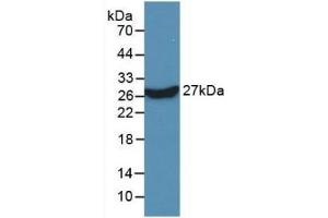 Detection of Recombinant KPNa2, Human using Monoclonal Antibody to Karyopherin Alpha 2 (KPNa2) (KPNA2 抗体  (AA 157-412))