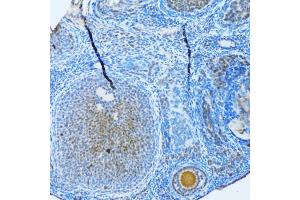 Immunohistochemistry of paraffin-embedded rat ovary using MAP1LC3B antibody (ABIN5973262) at dilution of 1/100 (20x lens).