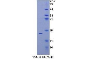 SDS-PAGE analysis of Human ELOB Protein. (TCEB2 蛋白)