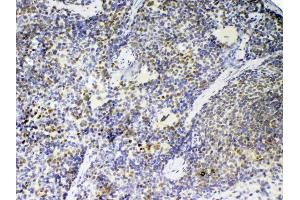Immunohistochemistry (IHC) image for anti-Tyrosine-Protein Phosphatase Non-Receptor Type 22 (PTPN22) (AA 1-309) antibody (ABIN5693124)