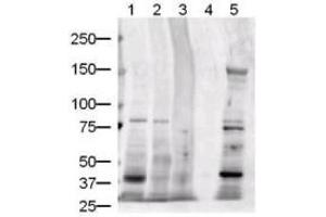 Image no. 3 for anti-Jagged 1 (JAG1) (AA 110-125) antibody (ABIN401024) (JAG1 抗体  (AA 110-125))