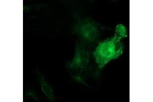 Anti-TUBB4 mouse monoclonal antibody (ABIN2454747) immunofluorescent staining of COS7 cells transiently transfected by pCMV6-ENTRY TUBB4 (RC203945). (TUBB4 抗体)