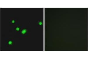 Immunofluorescence analysis of A549 cells, using MUTYH Antibody.