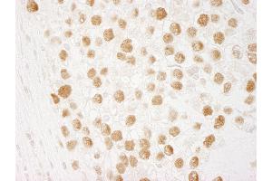 Immunohistochemistry (IHC) image for anti-CTF18, Chromosome Transmission Fidelity Factor 18 Homolog (CHTF18) (AA 25-75) antibody (ABIN7448948)