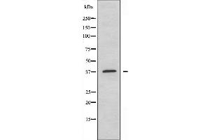 Western blot analysis of extracts from Jurkat cells using PRKAG1/2/3 antibody. (PRKAG1/2/3 抗体)
