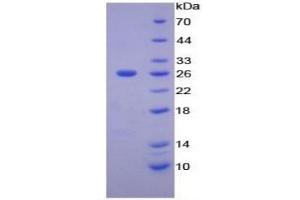 SDS-PAGE of Protein Standard from the Kit (Highly purified E. (MMP11 ELISA 试剂盒)