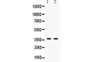 Western blot analysis of Annexin VIII using anti-Annexin VIII antibody . (Annexin VIII 抗体  (N-Term))