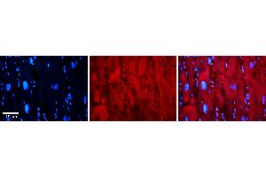 Immunohistochemistry (IHC) image for anti-Ewing Sarcoma Breakpoint Region 1 (EWSR1) (C-Term) antibody (ABIN2779536)
