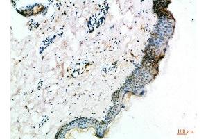 Immunohistochemical analysis of paraffin-embedded Human-skin, antibody was diluted at 1:100 (FZD4 抗体  (AA 11-60))