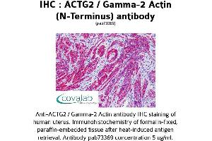 Image no. 1 for anti-Actin, gamma 2, Smooth Muscle, Enteric (ACTG2) antibody (ABIN1731474) (ACTG2 抗体)