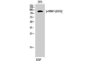 Western Blotting (WB) image for anti-Ribosomal Protein S6 Kinase, 90kDa, Polypeptide 5 (RPS6KA5) (pSer212) antibody (ABIN3179703) (MSK1 抗体  (pSer212))