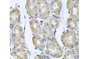 Immunohistochemistry of paraffin-embedded Human stomach using BAG5 Polyclonal Antibody at dilution of 1:100 (40x lens). (BAG5 抗体)