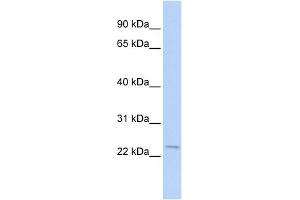 WB Suggested Anti-STK32A Antibody Titration: 0. (STK32A 抗体  (N-Term))