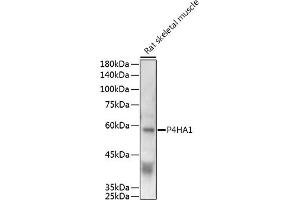Western blot analysis of extracts of Rat skeletal muscle, using P4H antibody (0538) at 1:500 dilution. (P4HA1 抗体  (AA 235-534))