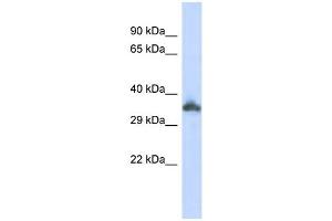 WB Suggested Anti-KRTAP24-1 Antibody Titration:  0. (KRTAP24-1 抗体  (Middle Region))