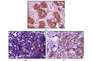 Immunohistochemical analysis of paraffin-embedded human breast tissue (A), lymph tissue (B) and skin carcinoma (C), showing membrane localization using BLK mouse mAb with DAB staining.
