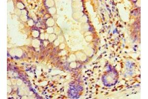 Immunohistochemistry of paraffin-embedded human small intestine tissue using ABIN7164411 at dilution of 1:100 (DIMT1 抗体  (AA 1-313))