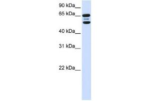 FBXO21 antibody used at 1 ug/ml to detect target protein. (FBXO21 抗体  (N-Term))