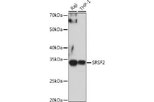Western blot analysis of extracts of various cell lines, using SRSF2 antibody (ABIN1682677, ABIN3017915, ABIN3017916, ABIN5664377 and ABIN6220303) at 1:1000 dilution. (SRSF2 抗体  (AA 1-75))
