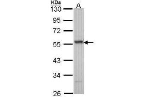 WB Image Sample (30 ug of whole cell lysate) A: H1299 10% SDS PAGE antibody diluted at 1:1000 (ERG 抗体  (C-Term))