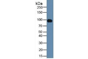 Rabbit Detection antibody from the kit in WB with Positive Control: Human serum. (HIF1A CLIA Kit)