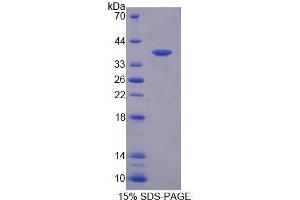 SDS-PAGE analysis of Human CEP55 Protein. (CEP55 蛋白)