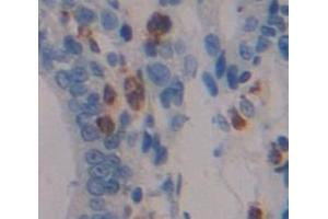 IHC-P analysis of Human Tissue, with DAB staining. (DUSP5 抗体  (AA 1-135))