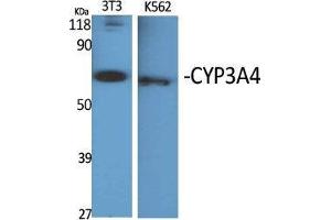 Western Blotting (WB) image for anti-Cytochrome P450, Family 3, Subfamily A, Polypeptide 4 (CYP3A4) (Internal Region) antibody (ABIN6284543)