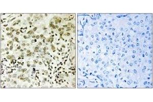 Immunohistochemistry (IHC) image for anti-CTD (Carboxy-terminal Domain, RNA Polymerase II, Polypeptide A) Small Phosphatase 1 (CTDSP1) (AA 1-50) antibody (ABIN1534738)