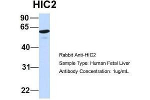 Host:  Rabbit  Target Name:  HIC2  Sample Type:  Human Fetal Liver  Antibody Dilution:  1. (HIC2 抗体  (Middle Region))