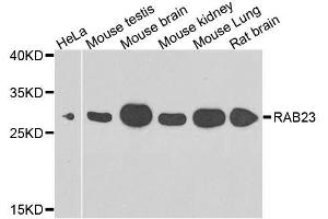 Western blot analysis of extracts of various cell lines, using RAB23 antibody. (RAB23 抗体  (AA 1-237))