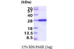 SDS-PAGE (SDS) image for Cellular Repressor of E1A-Stimulated Genes 1 (CREG1) (AA 32-220) protein (His tag) (ABIN5854797) (CREG1 Protein (AA 32-220) (His tag))