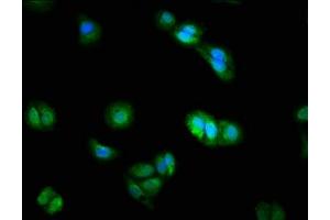 Immunofluorescence staining of HepG2 cells with ABIN7150786 at 1:200, counter-stained with DAPI. (DUSP9 抗体  (AA 142-263))