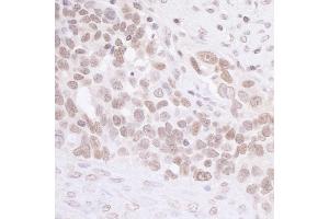 Immunohistochemistry (IHC) image for anti-MIS12, MIND Kinetochore Complex Component, Homolog (MIS12) (C-Term) antibody (ABIN7453483) (MIS12 抗体  (C-Term))